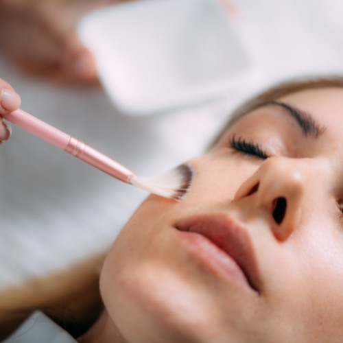 Chemical Peels